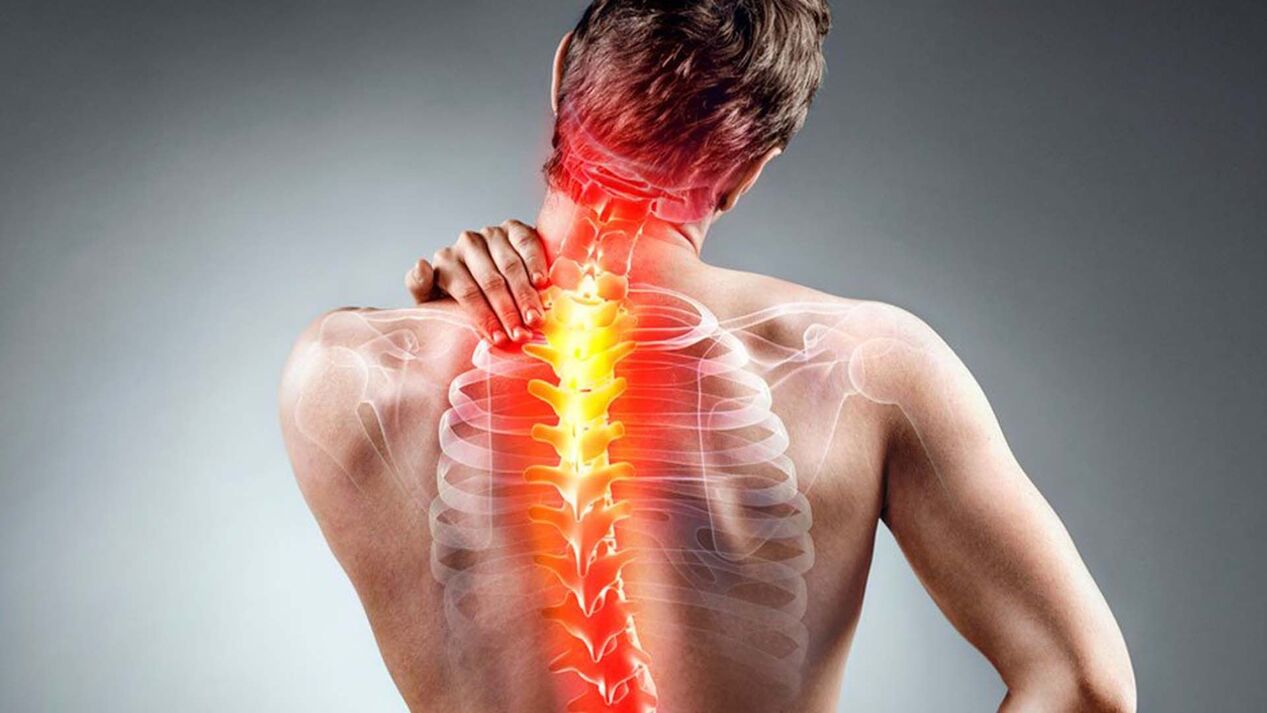 a gerinc osteochondrosisának tünetei